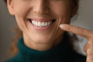 Crop close up of smiling young woman show white healthy even teeth after good quality dental...