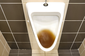 Dirty clogged urinal with water in the toilet of a restaurant. Disinfection and hygiene in toilets...