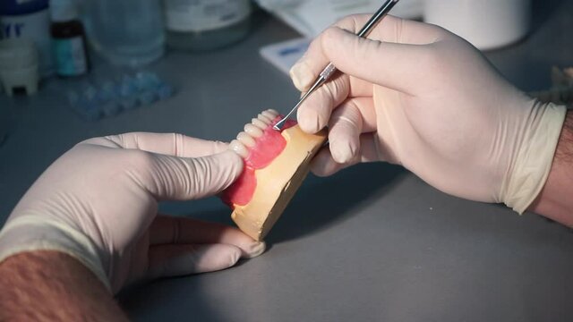 Dentist Hands in latex gloves adjusting acrylic denture gingival margins on cast