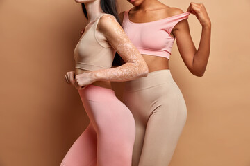 Unrecognizable women have perfect figure different skin condition pose in cropped top and leggings against brown background. Vitiligo affected female.