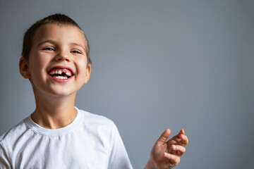 Boy without milk upper tooth in white t-shirt smiling on the gray background.