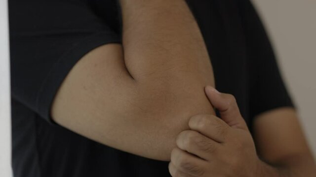 The young man has a skin disease. He has an itch in his arms. He scratched his elbow