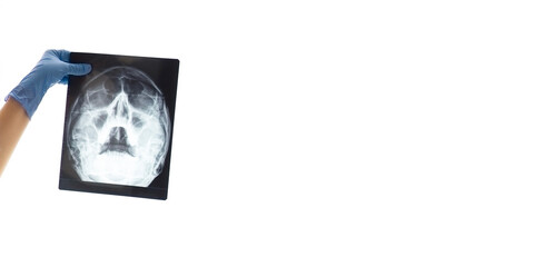 Fototapeta premium X-ray picture of the skull in doctor hand on white background . Banner with copy space .