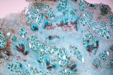 Host cells with spores (mold) are inside wood under the microscope for education.
