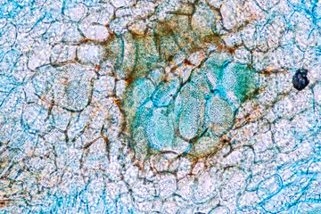 Host cells with spores (mold) are inside wood under the microscope for education.
