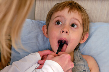 Sick child, toddler boy lying in bed with a fever, resting at home. Illness child. Doctor is watching throat