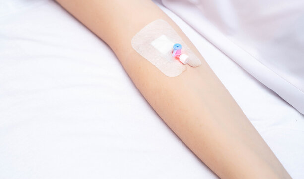 A venous catheter on the arm of a female patient on a white background. The concept of injecting drugs with a catheter. Copy space for text