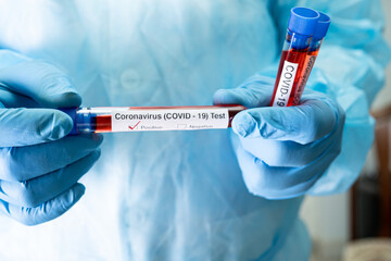 Positive blood infection sample in test tube for covid-19 coronavirus in lab. Scientist holding to check and analyze for patient in hospital.