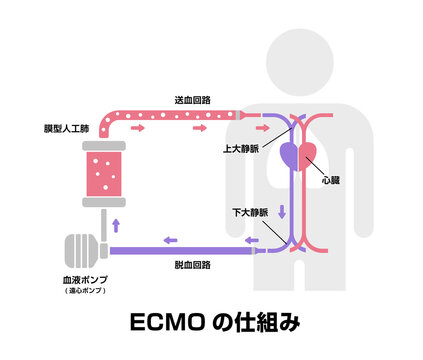 ECMO (エクモ) ・体外式膜型人工肺 の構造と仕組み /新型コロナウイルス, Covid-19
