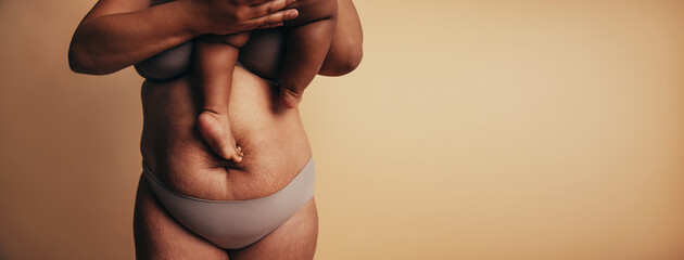 Postpartum belly with stretch marks - obrazy, fototapety, plakaty