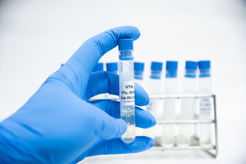 Viral transportation media (VTM)specimen collection Covid-19.