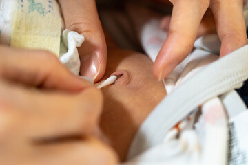 新生児のおへその消毒