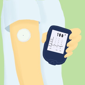 Blood glucose monitor