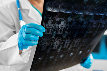 Hands of a doctor holding head mri scan