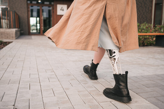 Legs Of A Young Girl With A Bionic Prosthesis, Back View