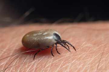 A tick drunk on blood crawls on human skin