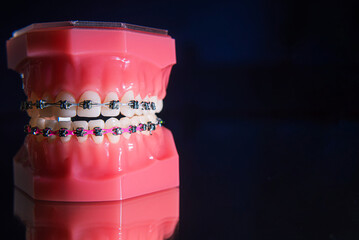 The braces are on the teeth in the artificial jaw on a black background. Close-up