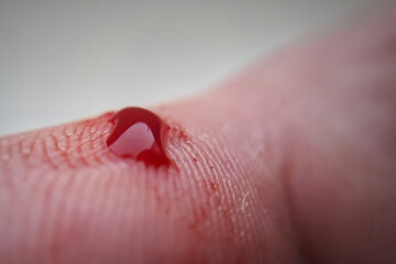Macro of a finger with a drop of blood. Bleeding blood from the cut finger wound. Injured finger...