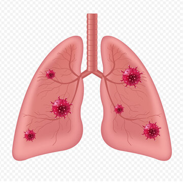 Lungs Human Internal Organ With Coronavirus Isolated White Background With Gradient Mesh, Vector Illustration