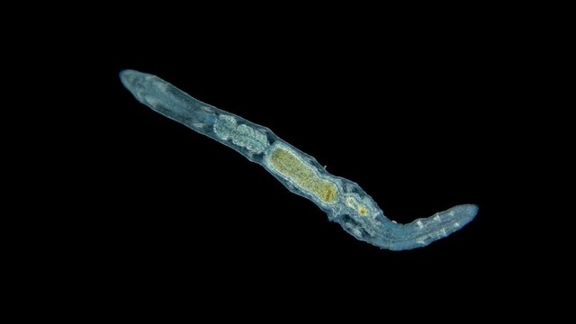 Oligochaeta Chaetogaster sp. under the microscope, family Tubificidae. It feeds on small algae, common in fresh water bodies. Sample found in the Volga River