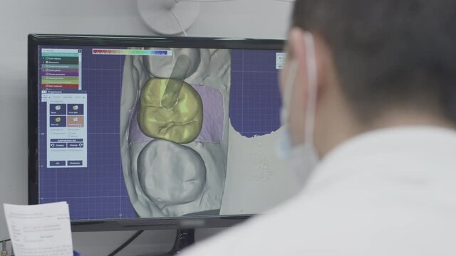 Doctor dentist works on a computer in a 3D program. Creates a model of a jaw prosthesis and ceramic teeth. Carries out diagnostics of the oral cavity. Application of new technologies in dentistry.