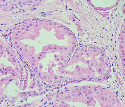 Photo of mammary duct with apocrine metaplasia, magnification 400x, photo under microscope
