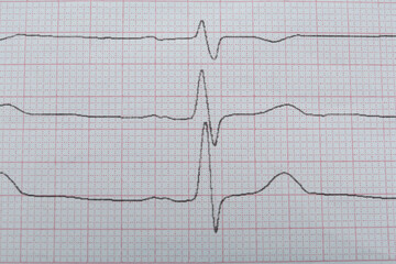 Cardiogram report as background, closeup. Heart diagnosis