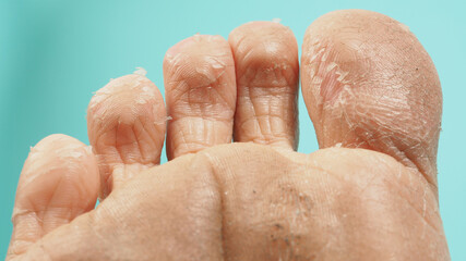 Close up of Foot peeling or remove dead skin on green or tiffany blue background.
