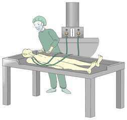 エンバーミングの「注入」工程で防腐固定液を注入する人2