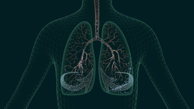 Cough medicine ad. Medical 3d animation of sick human lungs. Treatment virus infection, pneumonia, colds, asthma, coronavirus, or other lung diseases. 