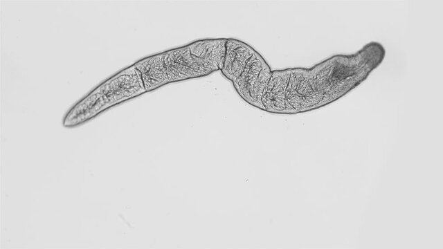 Nemertea worm under a microscope, supertype Spiralia, specimen with a sticky proboscis with venom, found in the Barents Sea