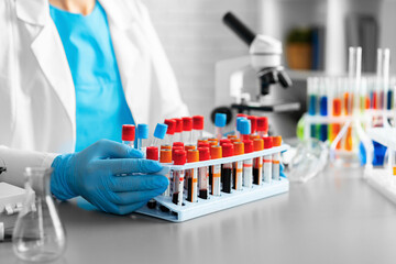 Hands of laboratory worker holding tray with blood samples
