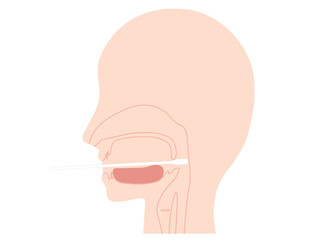 咽頭ぬぐい液　検体採取図