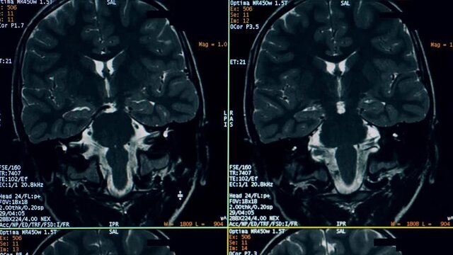 Dynamic CT images of a brain on the computer screen