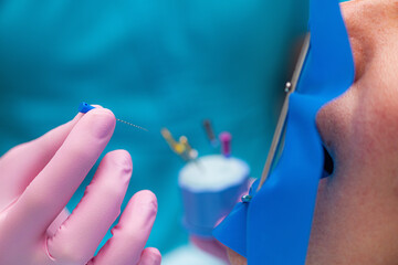 An Endodontist Preparing Barbed Broach for Endodontic Treatment in Dental Clinic.