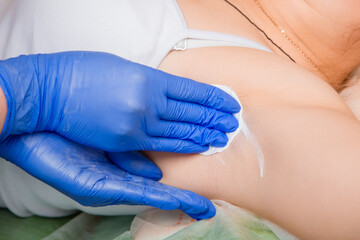 Close up of armpit hair removal process. The hands of the master in blue rubber gloves apply the hair remover.