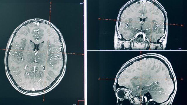 CT scan of human brain in dynamic