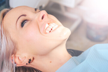 Smiling blonde girl in a dental chair with a cotton swab in her mouth.