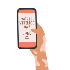 Vector illustration of hand with vitiligo skin disease holding phone. Concept of World Vitiligo Day June 25. Acceptance of self love. For blog, articles, banner, design