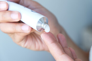 The woman's hand, she uses steroids Apply External type