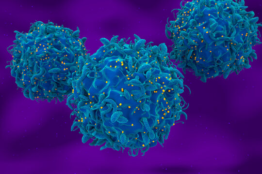 Hiv virus attack and infected t-cell 3d render illustration