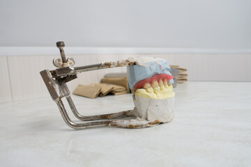 Fototapeta na wymiar wax preparations of removable dentures