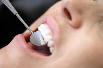 Extreme close up of beautiful young girl having dental check up. High quality photo