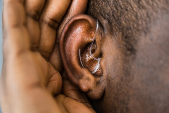 Hearing Aid And Audiology. Handicap