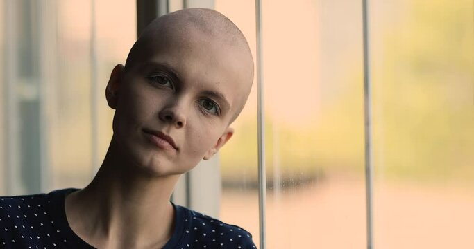 Close up portrait bald female cancer patient lean her shaved hairless head to window thinking about disease looking at camera. Moral exhaustion due to a serious incurable disease, hopelessness concept