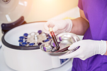 Platelet-Rich plasma preparation. Tube with blood in hands