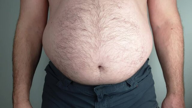 An overweight man cannot hold in his stomach anymore. Bulging belly.