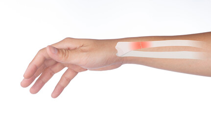 broken forearm bone feel pain and injury