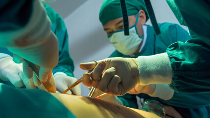 Team of professional doctors performing operation in surgery room