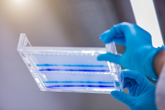 Scientist holding DNA sequencing gel in glass tray at laboratory